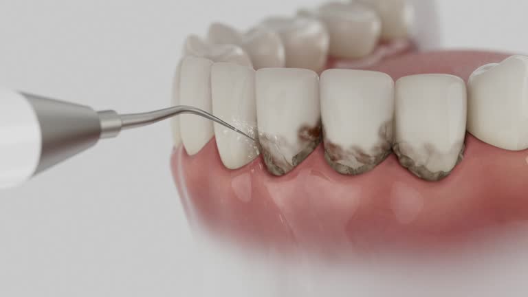 Reliable Dental contractor in Teague, TX by Smile Center Dentistry